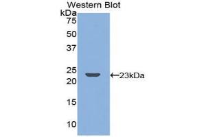 Western blot analysis of the recombinant protein. (TNFRSF11A antibody  (AA 359-542))