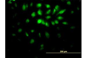 Immunofluorescence of monoclonal antibody to E2F6 on HeLa cell. (E2F6 antibody  (AA 1-281))