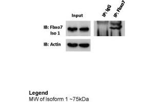 Immunoprecipitation -- 5ug antibody (FBXO7 antibody  (Middle Region))