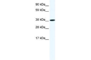 WB Suggested Anti-OBOX6 Antibody Titration:  1. (OBOX6 antibody  (Middle Region))