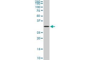 STX4A monoclonal antibody (M04), clone 6D1. (Syntaxin 4 antibody  (AA 19-119))
