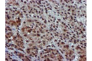 Image no. 14 for anti-Glutathione S-Transferase theta 2 (GSTT2) antibody (ABIN1498553) (GSTT2 antibody)