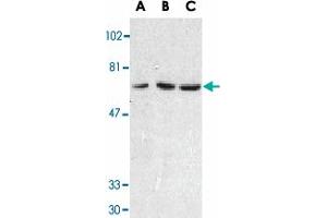 Western blot analysis of TNFRSF10C in HeLa cell (A), mouse (B) and rat (C) liver tissue lysates with TNFRSF10C polyclonal antibody  at 1 ug/mL .