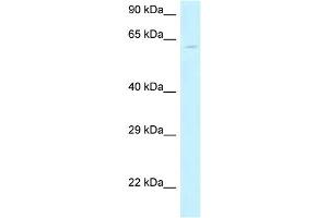 WB Suggested Anti-MON1B Antibody Titration: 1. (MON1B antibody  (N-Term))