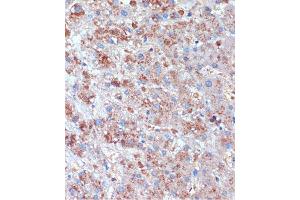 Immunohistochemistry of paraffin-embedded Human liver using TCIRG1 Rabbit pAb (ABIN7270707) at dilution of 1:100 (40x lens). (TCIRG1 antibody  (AA 1-130))