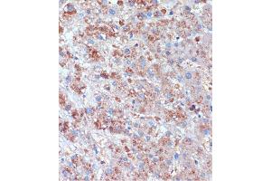 Immunohistochemistry of paraffin-embedded Human liver using TCIRG1 Rabbit pAb (ABIN7270707) at dilution of 1:100 (40x lens). (TCIRG1 antibody  (AA 1-130))