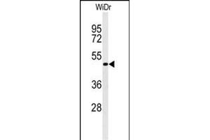 Western blot analysis of Phospho-GATA6-p (ABIN651256 and ABIN2840157) in WiDr cell line lysates (35 μg/lane).