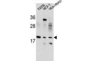 Western Blotting (WB) image for anti-Variable Charge, X-Linked (VCX) antibody (ABIN2995866)