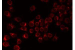 ABIN6276821 staining 293 by IF/ICC. (F12 antibody  (C-Term))