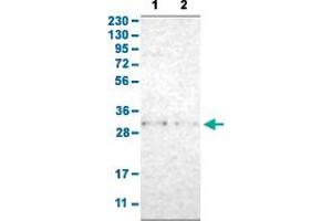 Western Blot analysis with TNFAIP1 polyclonal antibody .