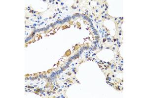 Immunohistochemistry of paraffin-embedded rat lung using CHI3L2 antibody (ABIN5975154) at dilution of 1/100 (40x lens). (CHI3L2 antibody)