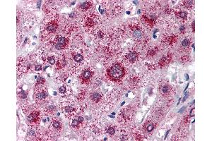 Anti-LDL Receptor antibody IHC of human liver. (LDLR antibody  (AA 499-511))
