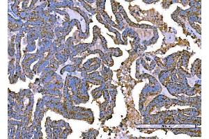 IHC analysis of RALBP1 using anti-RALBP1 antibody (ABIN7600800).