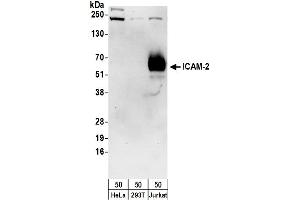 Western Blotting (WB) image for anti-Intercellular Adhesion Molecule 2 (ICAM2) (AA 1-50) antibody (ABIN7453105)
