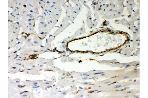 Anti- Vimentin Picoband antibody, IHC(P) IHC(P): Mouse Cardiac Muscle Tissue (Vimentin antibody  (C-Term))
