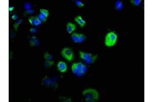 Immunofluorescence staining of MCF-7 cells with ABIN7146522 at 1:200, counter-stained with DAPI. (CAPNL1 antibody  (Catalytic Subunit))