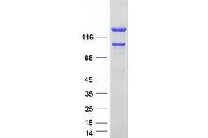 Validation with Western Blot (INF2 Protein (Transcript Variant 1) (Myc-DYKDDDDK Tag))
