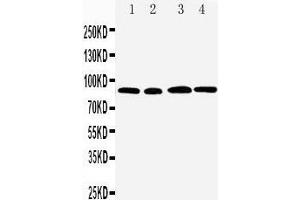 Anti-CD168 antibody, Western blotting Lane 1: MM231 Cell Lysate Lane 2: MM453 Cell Lysate Lane 3: HELA Cell Lysate Lane 4: A549 Cell Lysate
