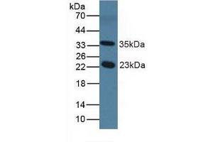 Detection of NOS1AP in Mouse Serum using Polyclonal Antibody to Nitric Oxide Synthase 1 Adaptor Protein (NOS1AP) (NOS1AP antibody  (AA 19-251))
