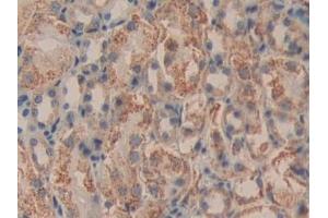 Detection of DLD in Mouse Kidney Tissue using Polyclonal Antibody to Dihydrolipoyl Dehydrogenase (DLD)