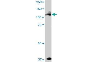ALPK1 MaxPab polyclonal antibody. (ALPK1 antibody  (AA 1-1085))