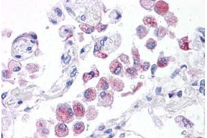 Human Lung: Formalin-Fixed, Paraffin-Embedded (FFPE) (NLRP14 antibody  (N-Term))