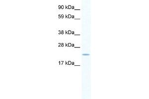 WB Suggested Anti-SERTAD1 Antibody   Titration: 0. (SERTAD1 antibody  (N-Term))