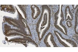 IHC analysis of U2AF65/U2AF2 using anti U2AF65/U2AF2 antibody (ABIN7600794). (U2AF2 antibody  (AA 238-470))
