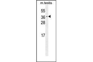 ODF3 antibody  (C-Term)