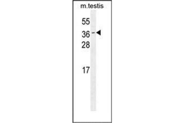 ODF3 antibody  (C-Term)