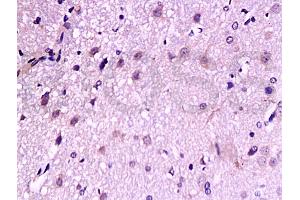 Formalin-fixed and paraffin embedded: rat brain tissue labeled with Anti-TrkB Polyclonal Antibody, Unconjugated (ABIN727310) at 1:200, followed by conjugation to the secondary antibody and DAB staining (TRKB antibody  (AA 32-120))