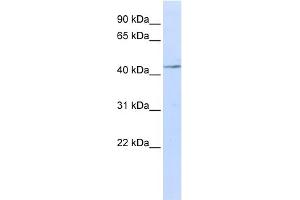WB Suggested Anti-IL11RA Antibody Titration:  0. (IL11RA antibody  (N-Term))