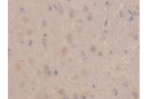 IHC-P analysis of Rat Cerebrum Tissue, with DAB staining. (RBP1 antibody  (AA 2-135))