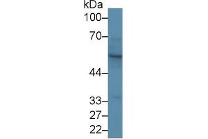 Western Blot; Sample: Rat Skin lysate; Primary Ab: 1µg/ml Rabbit Anti-Rat KRT15 Antibody Second Ab: 0. (KRT15 antibody  (AA 94-402))