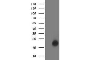 HEK293T cells were transfected with the pCMV6-ENTRY control (Left lane) or pCMV6-ENTRY LSM1 (Right lane) cDNA for 48 hrs and lysed. (LSM1 antibody)