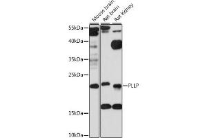 Western blot analysis of extracts of various cell lines, using PLLP antibody (ABIN7269390) at 1:1000 dilution. (Plasmolipin antibody  (AA 1-100))