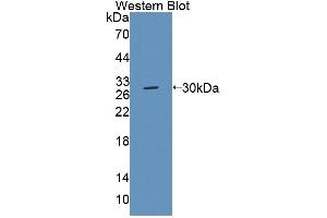 Western blot analysis of the recombinant protein. (ABCC6 antibody  (AA 1260-1498))