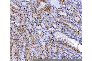 IHC analysis of YY1 using anti-YY1 antibody (ABIN7602999). (YY1 antibody  (Middle Region))