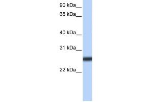 TMPRSS5 antibody used at 2 ug/ml to detect target protein.