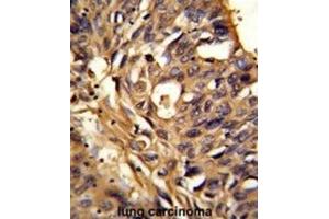 Immunohistochemistry (IHC) image for anti-Electron-Transferring-Flavoprotein Dehydrogenase (ETFDH) antibody (ABIN3002851) (ETFDH antibody)