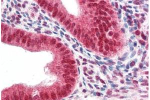 Human Uterus (formalin-fixed, paraffin-embedded) stained with CBX5 antibody ABIN337121 at 2. (CBX5 antibody  (AA 88-102))