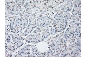 Image no. 8 for anti-Glial Fibrillary Acidic Protein (GFAP) antibody (ABIN1498441) (GFAP antibody)