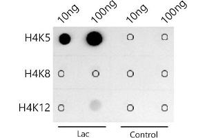 Dot-blot analysis of all sorts of peptides using Acetyl-Histone H4-K5 antibody (ABIN7267743) at 1:1000 dilution. (Histone H4 antibody  (acLys5))