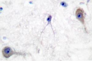 Image no. 1 for anti-Patched 1 (PTCH1) antibody (ABIN271777)