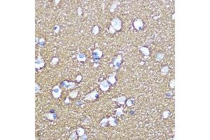 Immunohistochemistry of paraffin-embedded human brain using SN Rabbit pAb (ABIN3021231, ABIN3021232, ABIN3021233 and ABIN6214078) at dilution of 1:100 (40x lens).