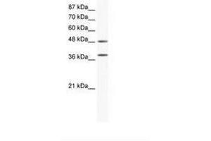 Image no. 1 for anti-Mitogen-Activated Protein Kinase 14 (MAPK14) (C-Term) antibody (ABIN203076) (MAPK14 antibody  (C-Term))