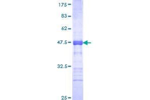 CTCFL Protein (AA 193-293) (GST tag)