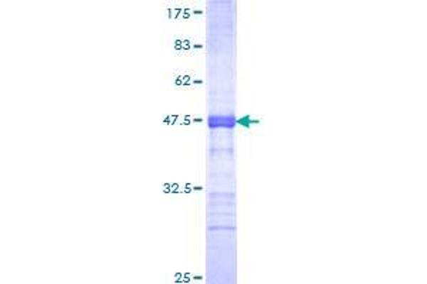 CTCFL Protein (AA 193-293) (GST tag)