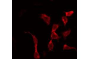ABIN6266757 staining HeLa by IF/ICC. (ABCF1 antibody  (C-Term))