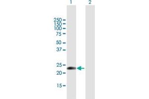 Western Blot analysis of EDN1 expression in transfected 293T cell line by EDN1 MaxPab polyclonal antibody. (Endothelin 1 antibody  (AA 1-212))